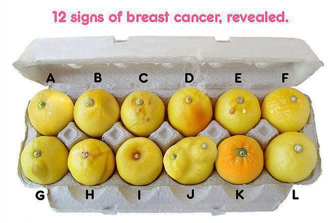  signs of breast cancer,prevent breast cancer, detection,treatment, diagnosis, symptoms, health tips,healthy food, Ann Kulze, M.D.