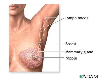 breast cancer,women,ANTI-PERSPIRANT,deodorant