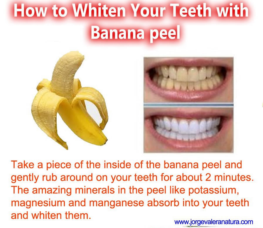  whiten teeth,Health tips ,benifits of banana,,healthy living,home made remedy, Health Inspirations ,Tips ,picture,
