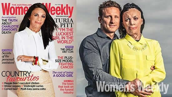 Turia Pitt,Inspirational story ,Quotes – Inspirational Quotes, Pictures and Motivational Thoughts
